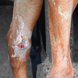 wounded horse - WestmountMag.ca