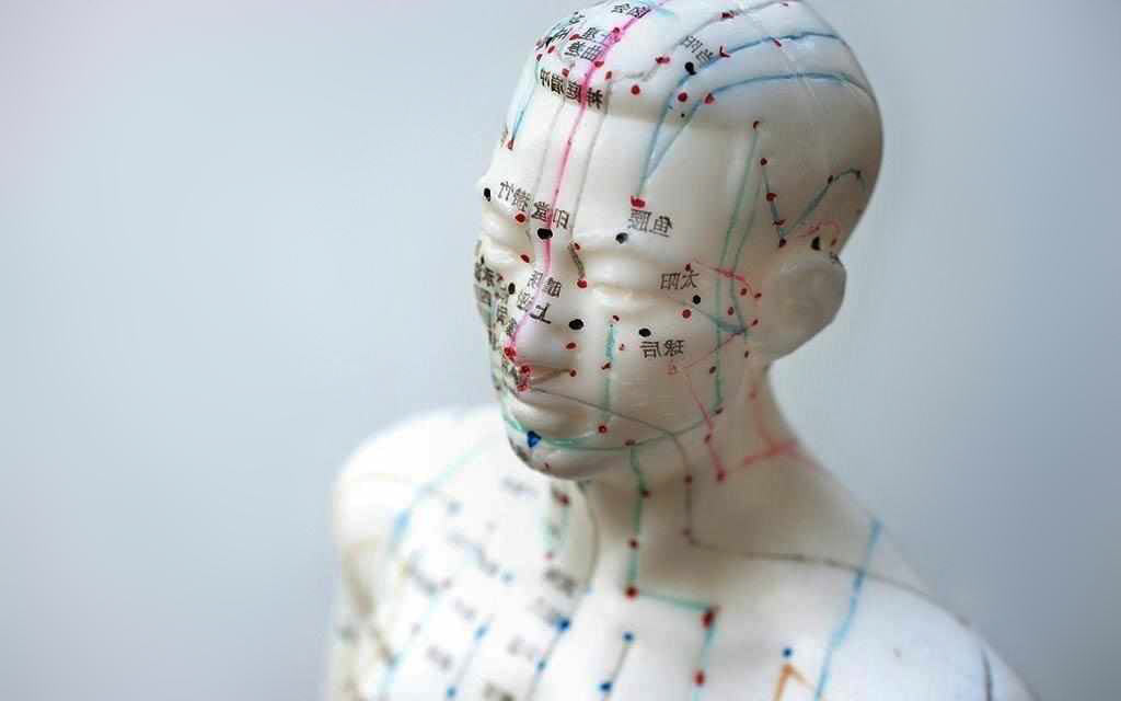 acupuncture_1024