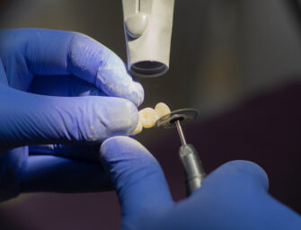 Maple Family Dentistry for <br>maintaining good oral health